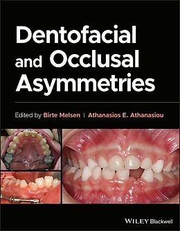 Livre Relié Dentofacial and Occlusal Asymmetries de Birte (Royal Dental College, Univerity of Melsen