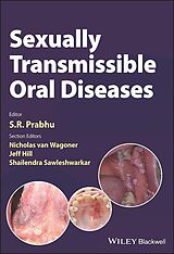 eBook (epub) Sexually Transmissible Oral Diseases de 