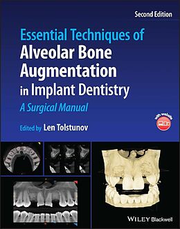 E-Book (pdf) Essential Techniques of Alveolar Bone Augmentation in Implant Dentistry von 