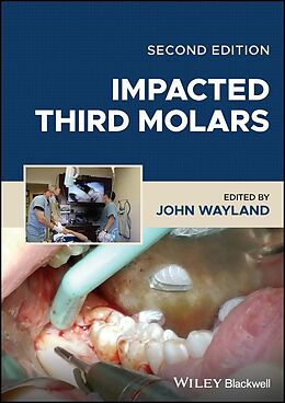 eBook (pdf) Impacted Third Molars de 