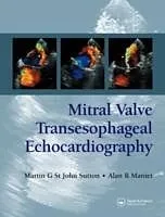 E-Book (epub) Mitral Valve Transesophageal Echocardiography von Martin G. St. John Sutton, Alan R. Maniet