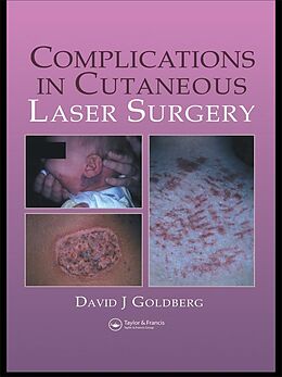 E-Book (epub) Complications in Laser Cutaneous Surgery von David J. Goldberg
