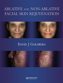 E-Book (epub) Ablative and Non-ablative Facial Skin Rejuvenation von David J. Goldberg