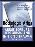 ePUB A Radiologic Atlas of Abuse, Torture, Terrorism, and Inflicted Trauma von B. G. Brogdon, Hermann Vogel, John D. McDowell