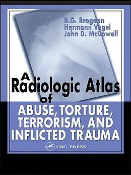 ePUB A Radiologic Atlas of Abuse, Torture, Terrorism, and Inflicted Trauma von B. G. Brogdon, Hermann Vogel, John D. McDowell