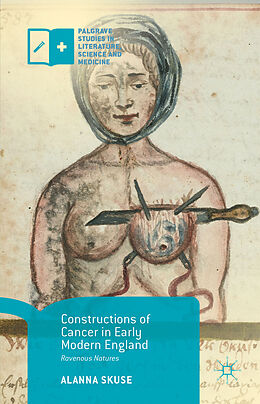 Kartonierter Einband Constructions of Cancer in Early Modern England von Alanna Skuse