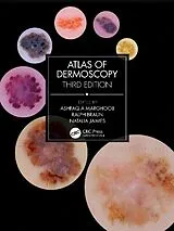 Fester Einband Atlas of Dermoscopy von Ashfaq A Marghoob, Ralph Braun, Natalia Jaimes