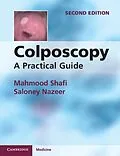 E-Book (epub) Colposcopy von Mahmood Shafi