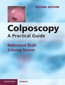 E-Book (epub) Colposcopy von Mahmood Shafi