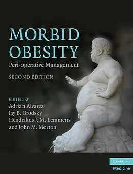 ePUB Morbid Obesity von 
