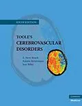 E-Book (epub) Toole's Cerebrovascular Disorders von E. Steve Roach