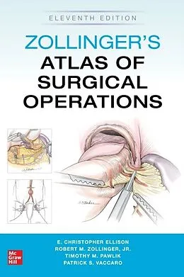 E-Book (epub) Zollinger's Atlas of Surgical Operations, Eleventh Edition von Robert M. Zollinger, E. Christopher Ellison, Timothy M. Pawlik