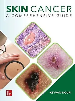 E-Book (epub) Skin Cancer: A Comprehensive Guide von Keyvan Nouri