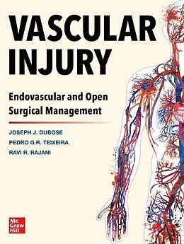 E-Book (epub) Vascular Injury: Endovascular and Open Surgical Management von Joe DuBose, Pedro G. Teixeira, Ravi R. Rajani