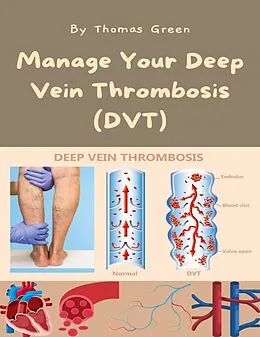 E-Book (epub) Manage Your Deep Vein Thrombosis (DVT) von Thomas Green