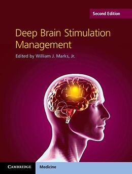 E-Book (pdf) Deep Brain Stimulation Management von 