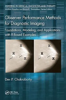 E-Book (epub) Observer Performance Methods for Diagnostic Imaging von Dev P. Chakraborty