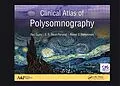 PDF Clinical Atlas of Polysomnography von Ravi Gupta, S. R. Pandi-Perumal, Ahmed S. Bahammam