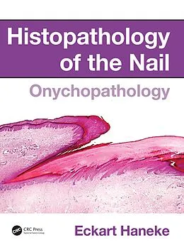 E-Book (epub) Histopathology of the Nail von Eckart Haneke
