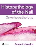 E-Book (pdf) Histopathology of the Nail von Eckart Haneke