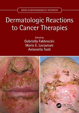 eBook (epub) Dermatologic Reactions to Cancer Therapies de 