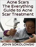 E-Book (epub) Acne Scars: The Everything Guide to Acne Scar Treatment von John Sokolowski