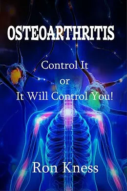 E-Book (epub) Osteoarthritis (Senior Health, #1) von Ron Kness