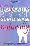 E-Book (epub) How to Heal Cavities and Reverse Gum Disease Naturally: a science-based, proven plan to heal teeth and gums using nutrition, balancing the metabolism, and natural therapies such as oil pulling von Joey Lott