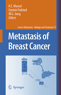 Livre Relié Metastasis of Breast Cancer de 