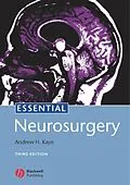 E-Book (pdf) Essential Neurosurgery von Andrew H. Kaye