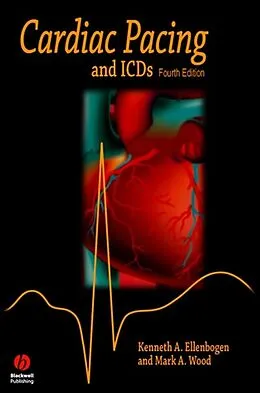 E-Book (pdf) Cardiac Pacing and ICDs von Kenneth A. Ellenbogen, Mark A. Wood