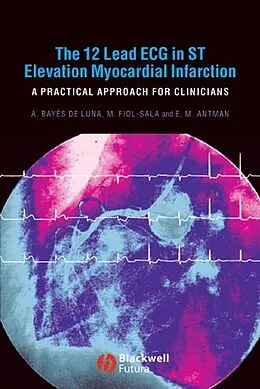 E-Book (pdf) The 12 Lead ECG in ST Elevation Myocardial Infarction von Antonio Bay&eacute;s de Luna, Miquel Fiol-Sala, Elliot M. Antman