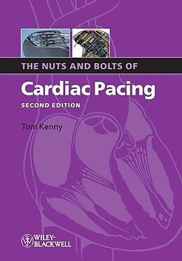 Kartonierter Einband The Nuts and Bolts of Cardiac Pacing von Tom (St. Jude Medical, Austin, Texas) Kenny