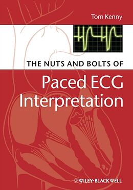 Kartonierter Einband The Nuts and bolts of Paced ECG Interpretation von Tom Kenny