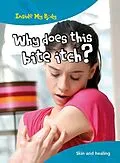E-Book (pdf) Why does this Bite Itch? von Steve Parker