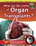 E-Book (pdf) What Are the Limits of Organ Transplantation? von Anna Claybourne