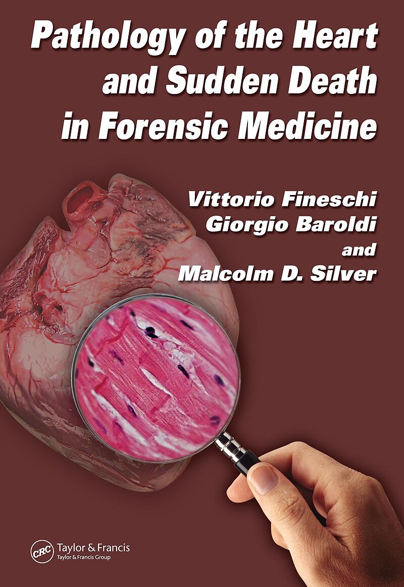 Pathology of the Heart and Sudden Death in Forensic Medicine