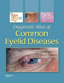 PDF Diagnostic Atlas of Common Eyelid Diseases von Jonathan J. Dutton, Gregg S. Gayre, Alan D. Proia