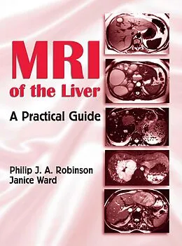 E-Book (pdf) MRI of the Liver von Philip J. A. Robinson, Janice Ward