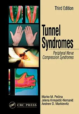 E-Book (pdf) Tunnel Syndromes von Marko M. Pecina, Andrew D. Markiewitz, Jelena Krmpotic-Nemanic