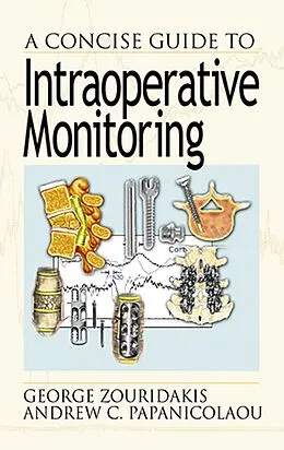 E-Book (pdf) A Concise Guide to Intraoperative Monitoring von George Zouridakis, Andrew C. Papanicolaou