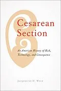 E-Book (epub) Cesarean Section von Jacqueline H. Wolf