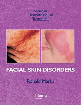 E-Book (pdf) Facial Skin Disorders von Ronald Marks