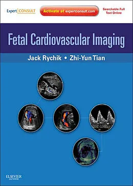 E-Book (epub) Fetal Cardiovascular Imaging E-Book von Facc Rychik MD, Rdcs Tian MD