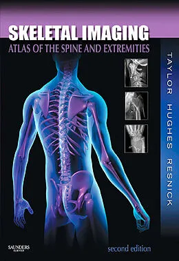 E-Book (epub) Skeletal Imaging von Dacbr Taylor DC, Frcr Hughes MD, Donald L. Resnick MD
