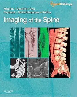 E-Book (pdf) Imaging of the Spine E-Book von Thomas P. Naidich MD, Mauricio Castillo MD, Soonmee Cha MD