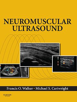 eBook (epub) Neuromuscular Ultrasound E-Book de Francis Walker, Michael S. Cartwright