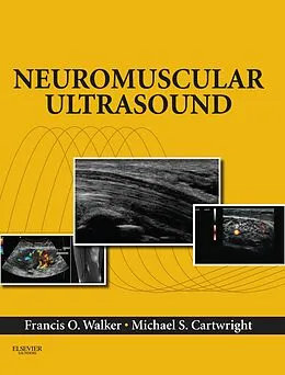 E-Book (epub) Neuromuscular Ultrasound E-Book von Francis Walker MD, Michael S. Cartwright MD