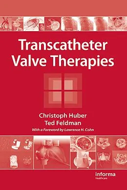 PDF Transcatheter Valve Therapies von Christoph Huber, Ted Feldman