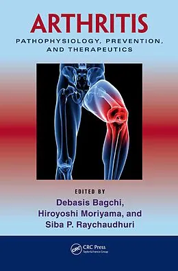 E-Book (pdf) Arthritis von Debasis Bagchi